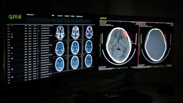 Qure.ai to deploy advanced AI for medical imaging across N-Europe